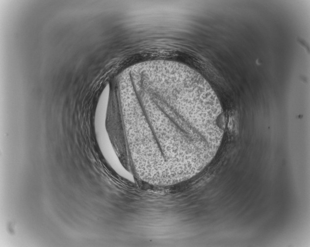 X0000099290771200805301111