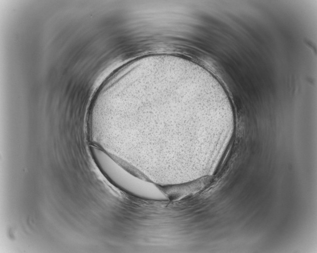 X0000099290803200805301110
