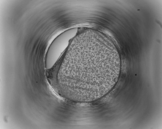 X0000099290808200805301110