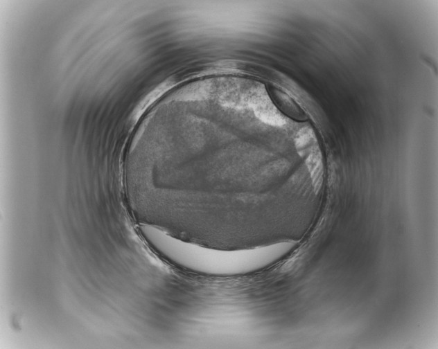 X0000099290858200805301110