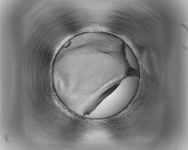 X0000099290864200805301110