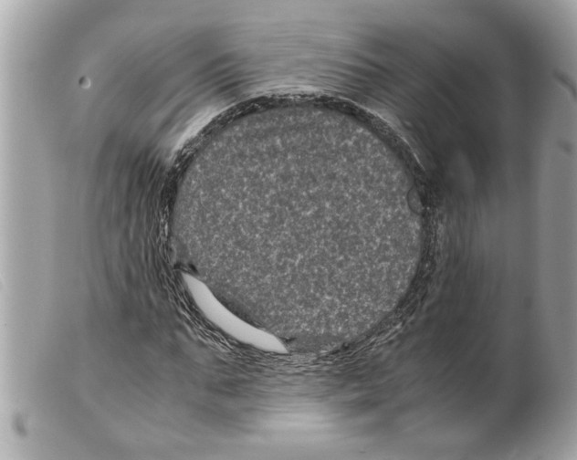 X0000099290871200805301109
