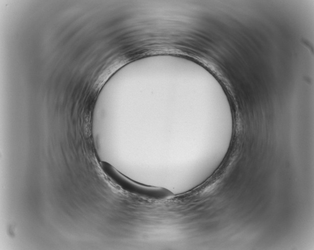 X0000099290905200805301109