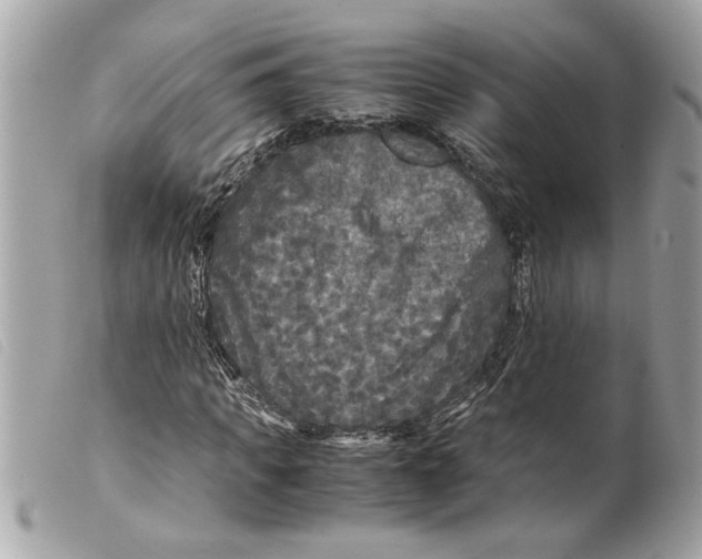 X0000099290917200805301108