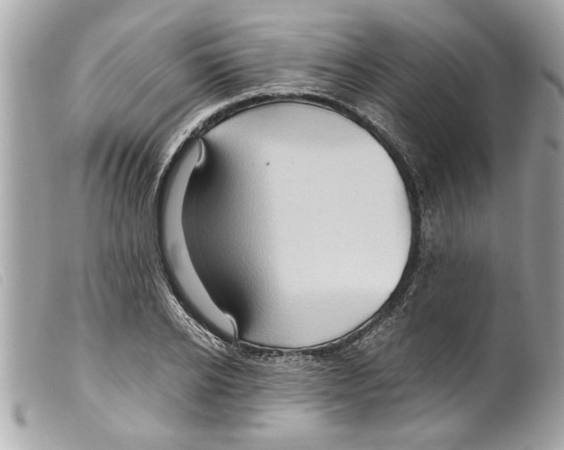 X0000099290934200805301108