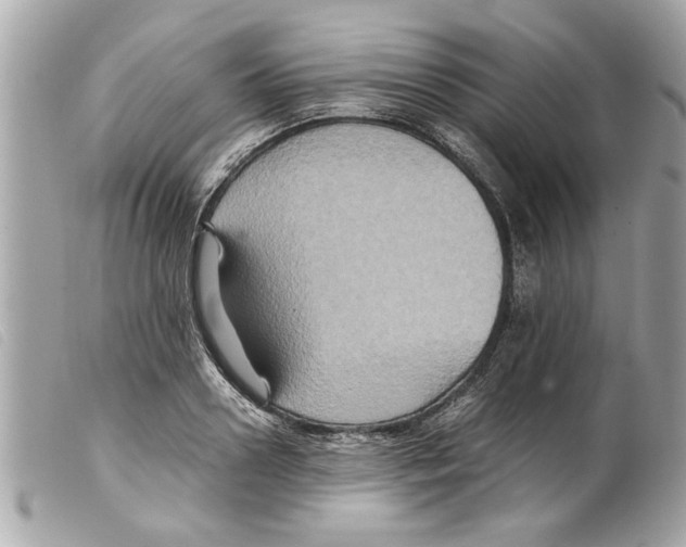 X0000099290938200805301108