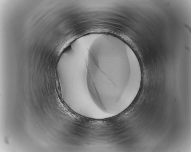 X0000099290945200805301109