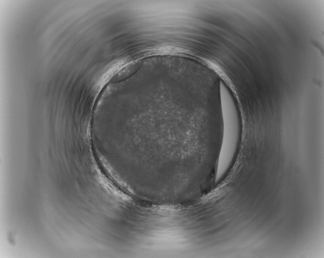X0000099290946200805301109