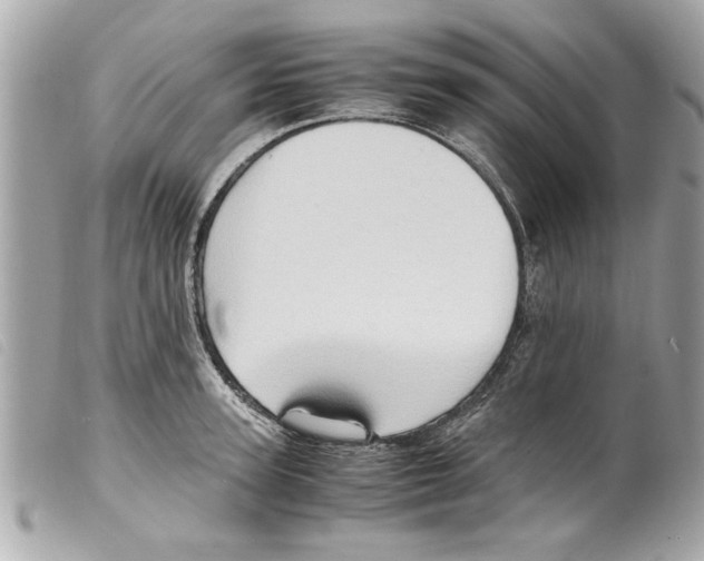 X0000099290947200805301109