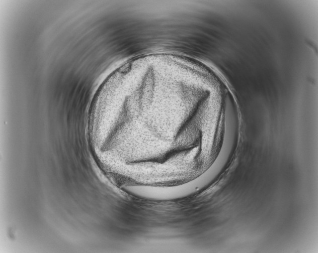 X0000099290957200805301109