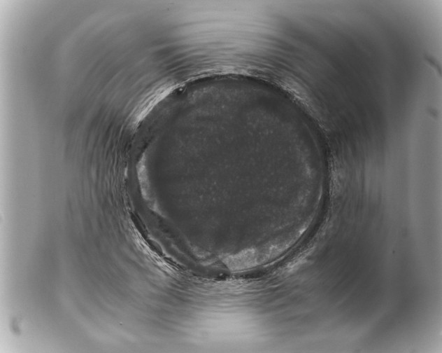 X0000099290977200805301108