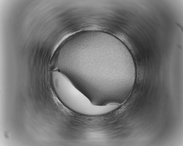 X0000099291000200805301107