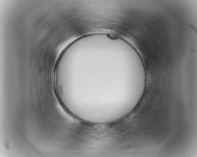X0000099291003200805301107