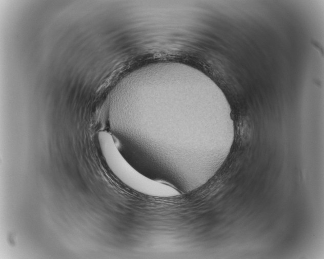 X0000099291012200805301107