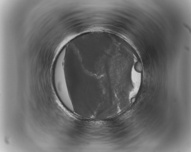 X0000099291045200805301107