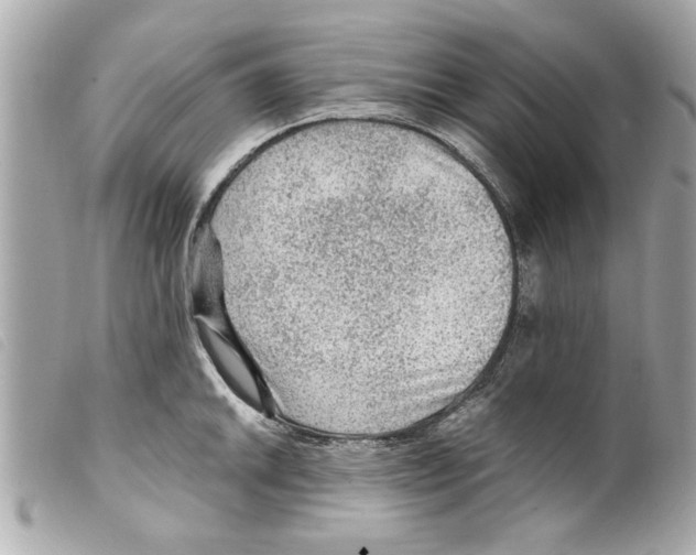 X0000099291046200805301107