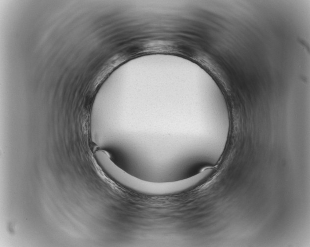 X0000099291049200805301107