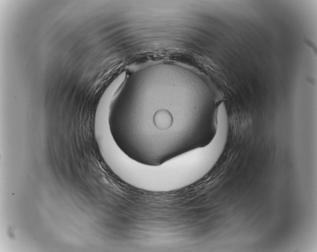 X0000099291060200805301107
