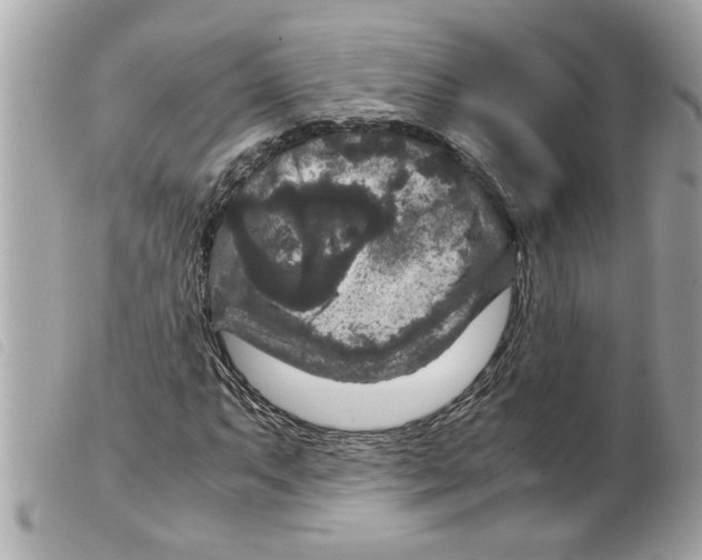 X0000099291063200805301107
