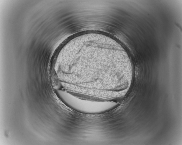 X0000099291068200805301106