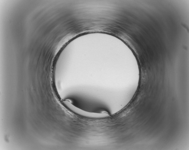 X0000099291093200805301106