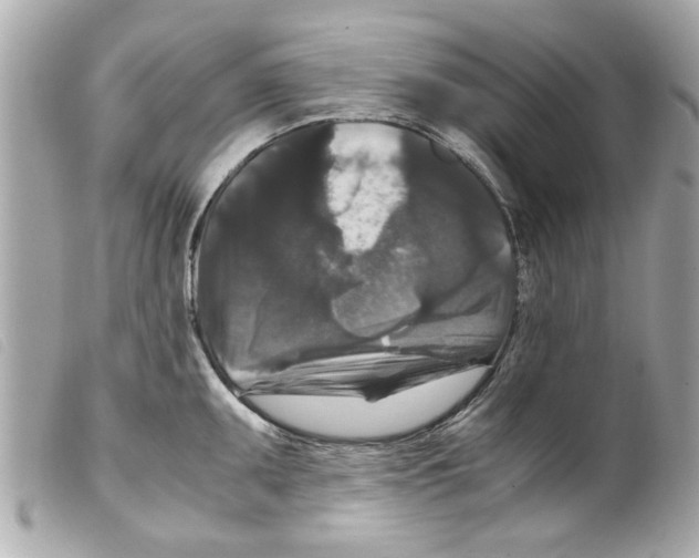 X0000099291095200805301106