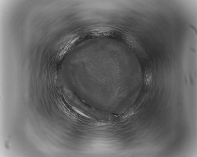 X0000099291108200805301105
