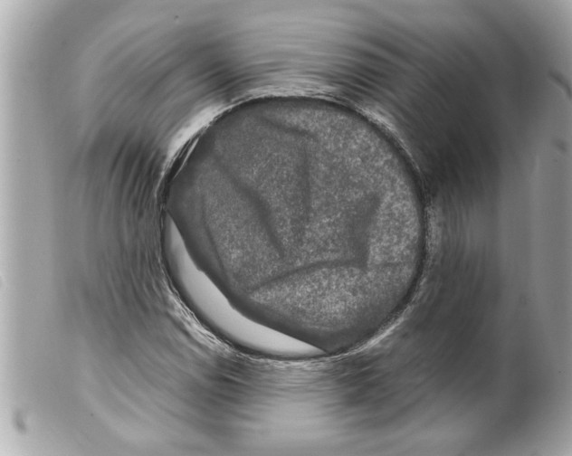 X0000099291114200805301106