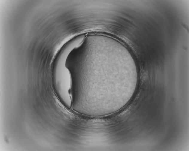 X0000099291118200805301106