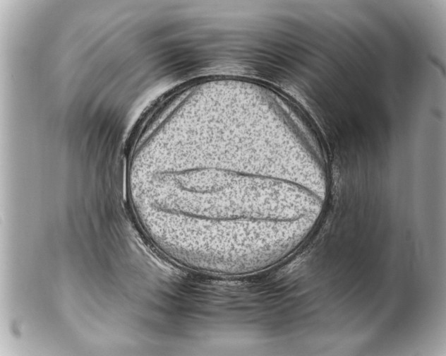X0000099291123200805301106