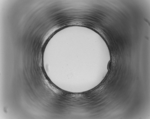 X0000099291131200805301106