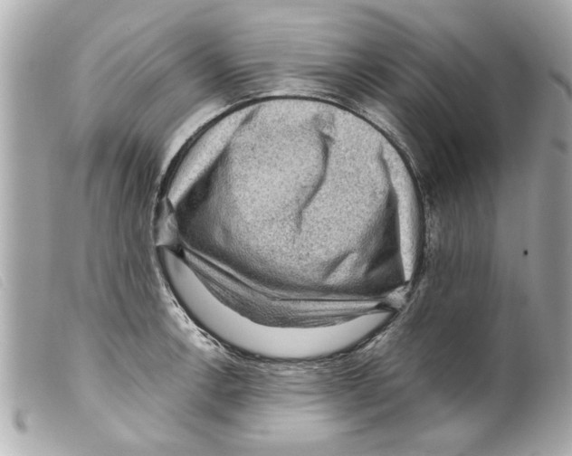 X0000099291138200805301106