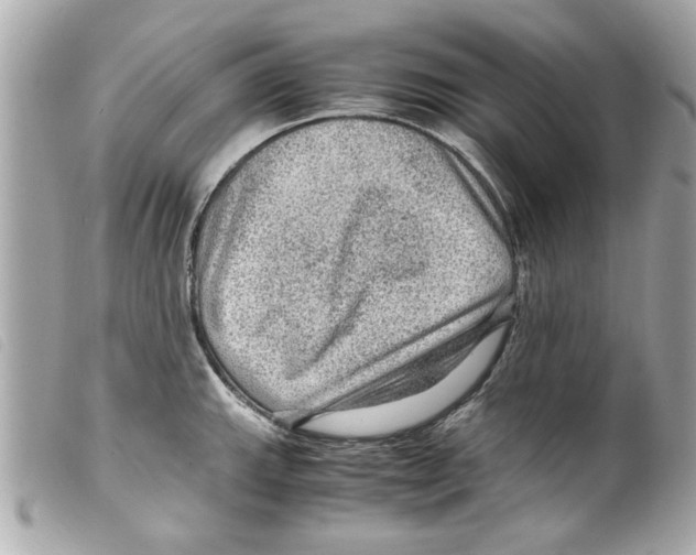 X0000099291143200805301106