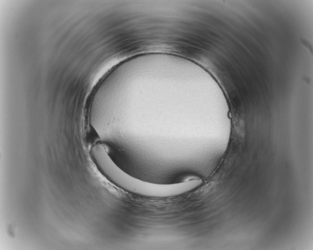 X0000099291147200805301106