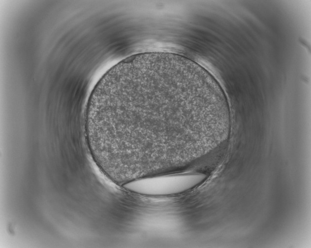 X0000099291152200805301106