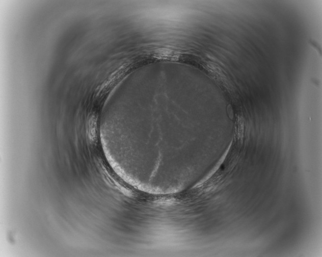 X0000099291154200805301105
