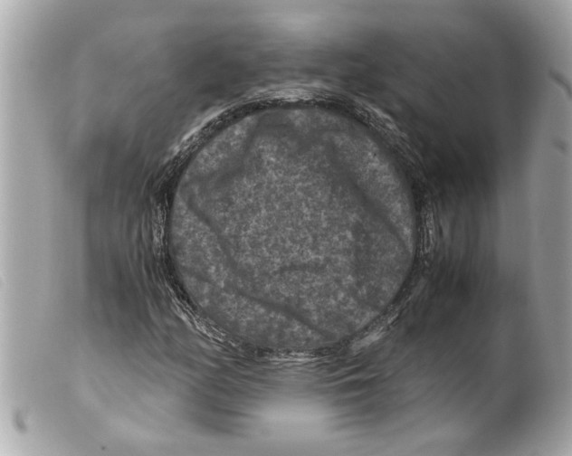 X0000099291158200805301105