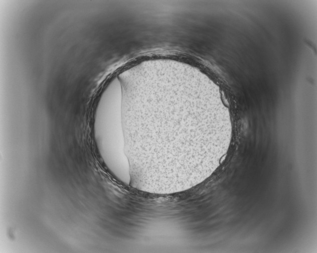 X0000099291160200805301105