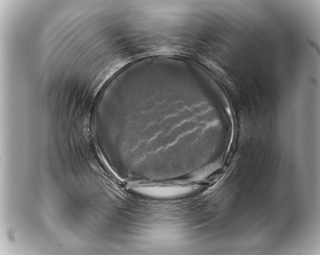 X0000099291170200805301105