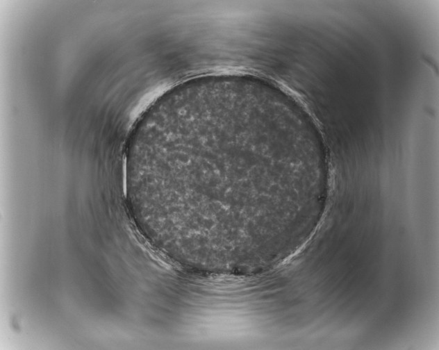 X0000099291171200805301105