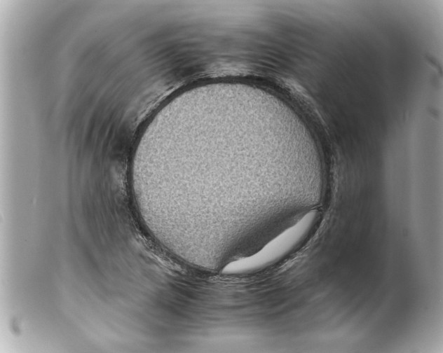 X0000099291217200805301104