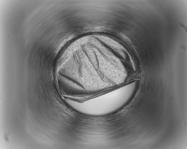 X0000099291218200805301104