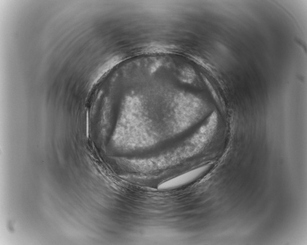 X0000099291219200805301104