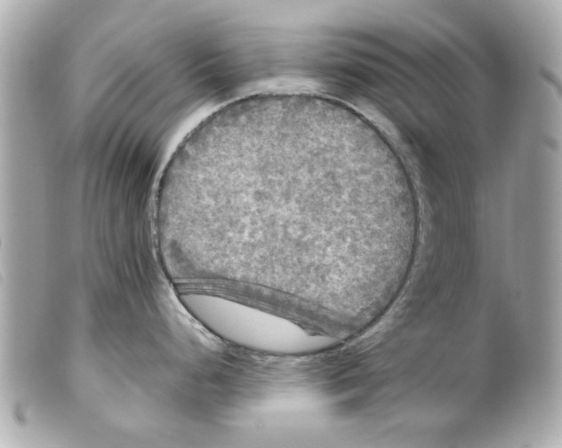X0000099291248200805301105
