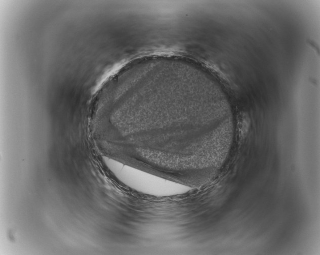 X0000099291256200805301104