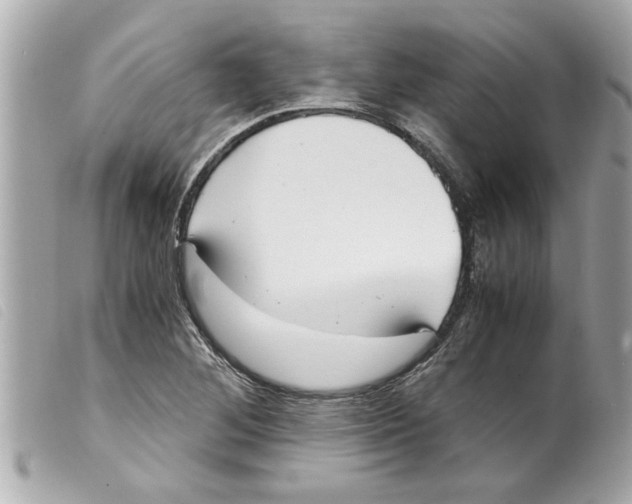 X0000099291268200805301104