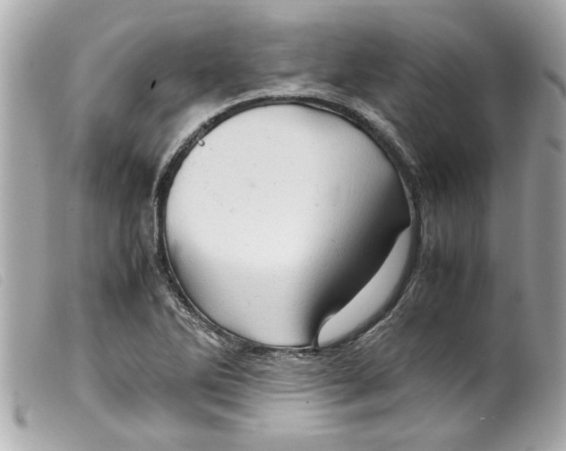 X0000099291270200805301104