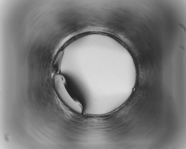 X0000099291272200805301104