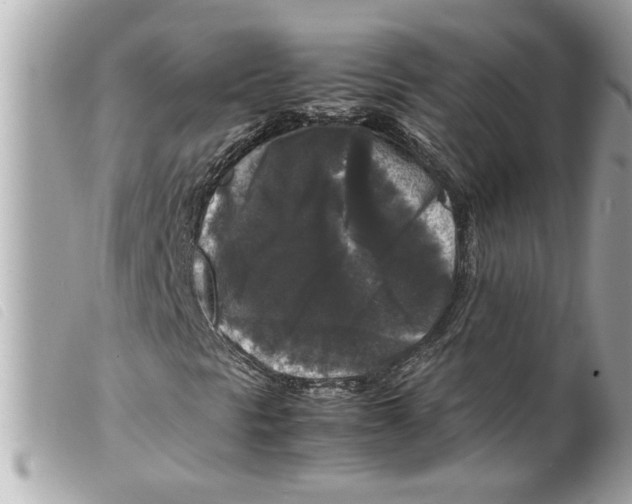 X0000099291297200805301103