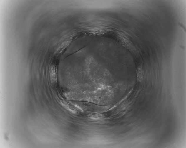 X0000099291298200805301103